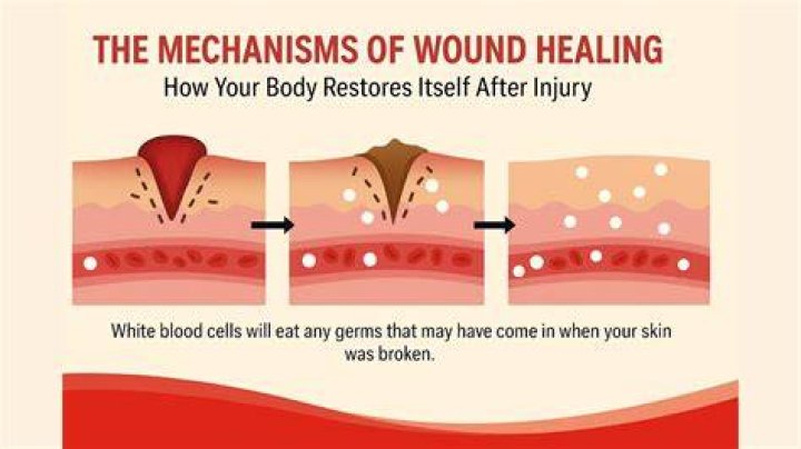 Can ginger heal wounds?