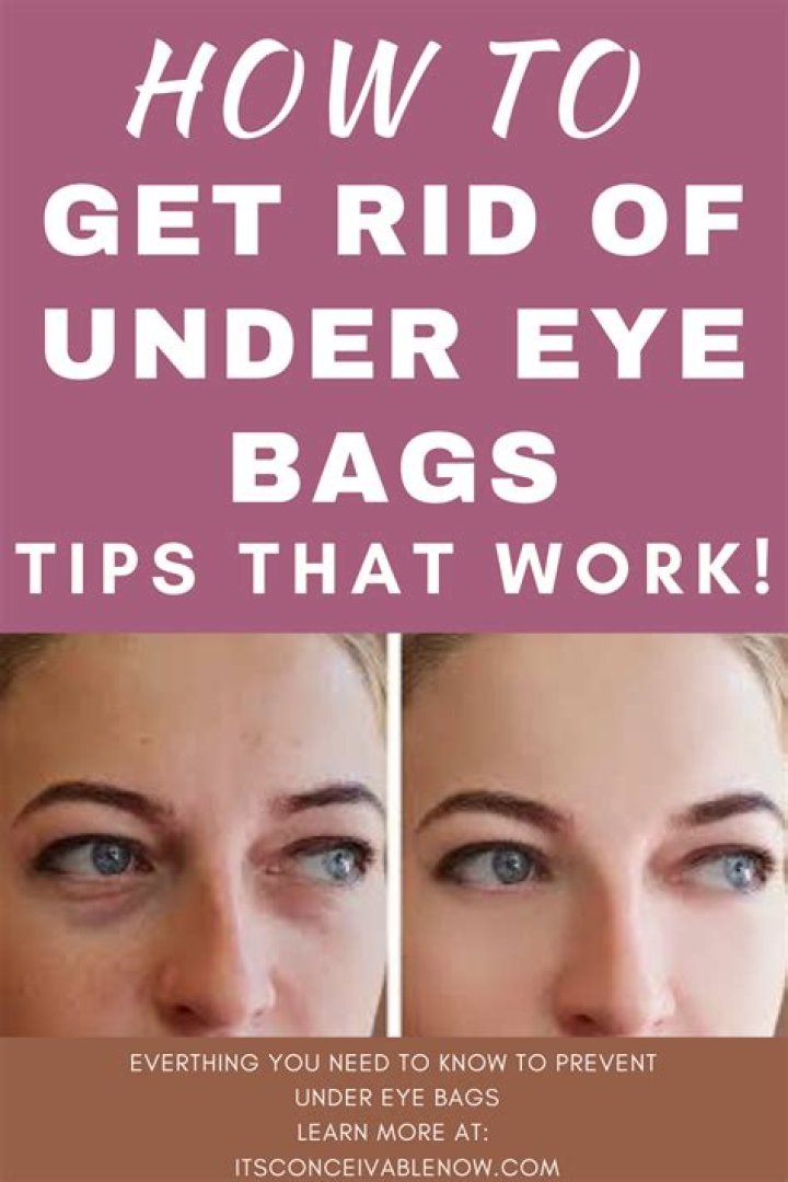 Does drinking water help under eye bags?