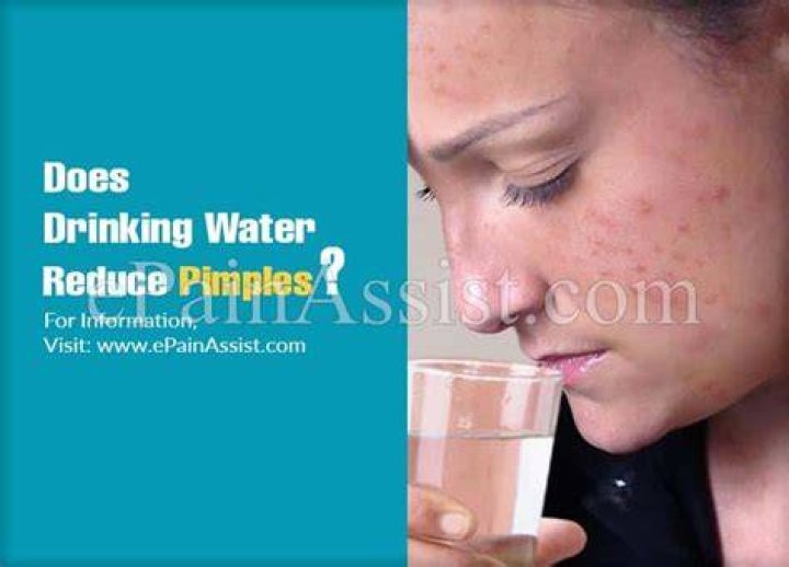 Does drinking water reduce pigmentation?