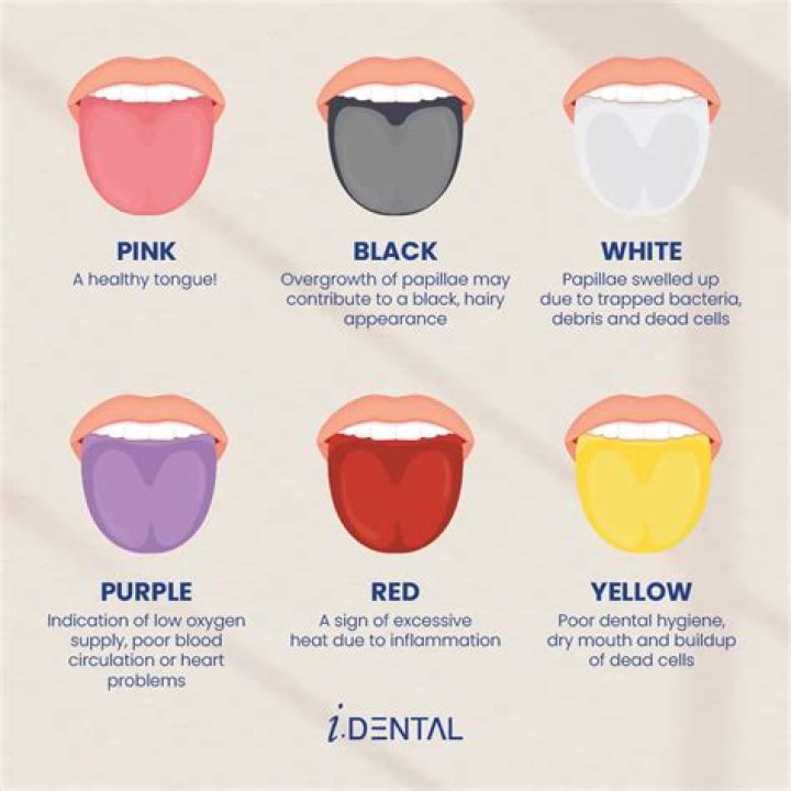 Does Salt clean your tongue?