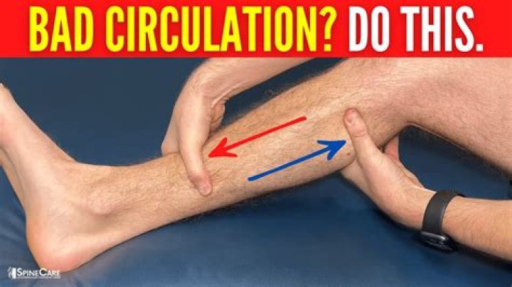 How do doctors check for poor circulation?
