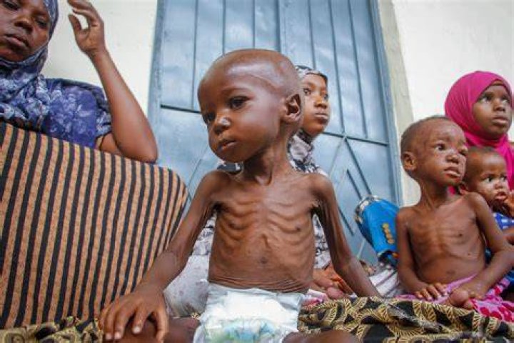 Is Africa a starving country?