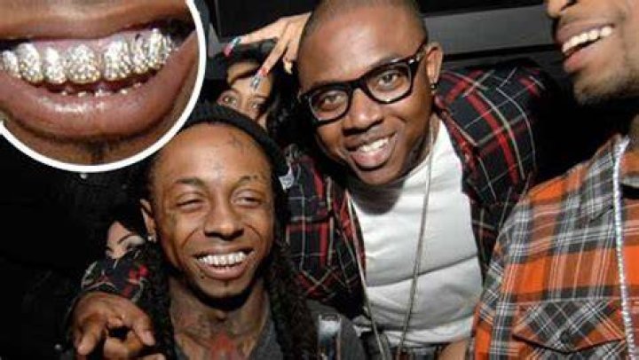 Is Lil Wayne's grill permanent?