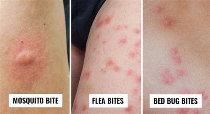 What do Bedbug bites look like at first?