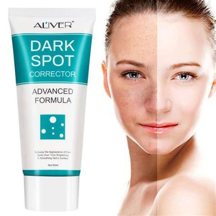 What is a good product to remove dark spots on face?