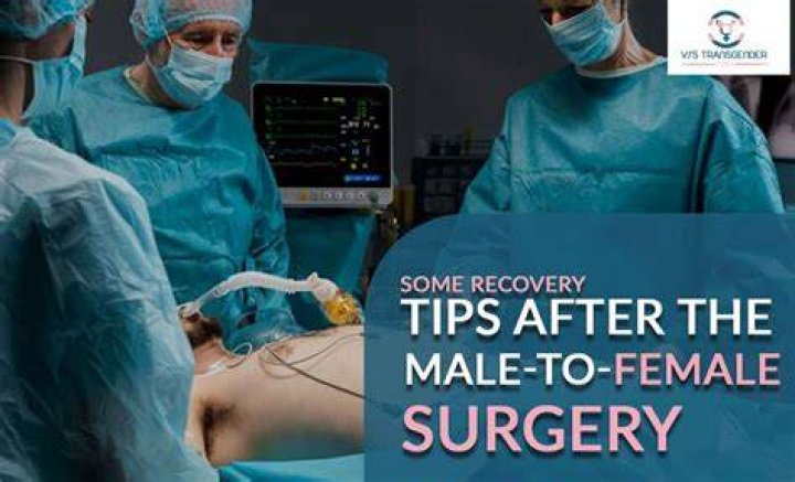 What is top surgery?