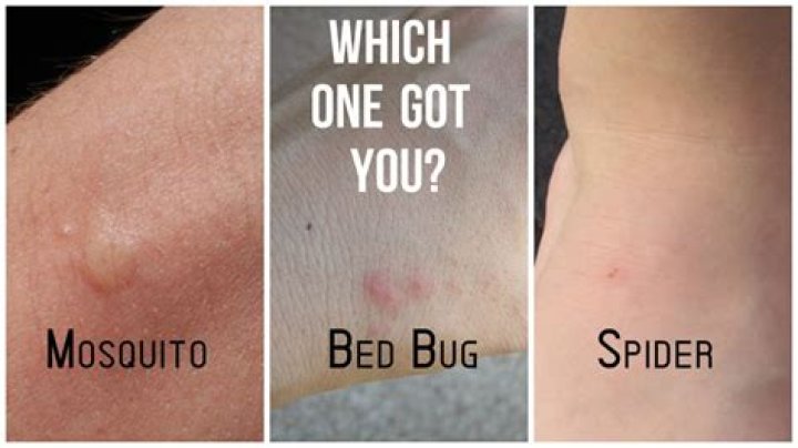 Why do mosquitoes bite me so much?