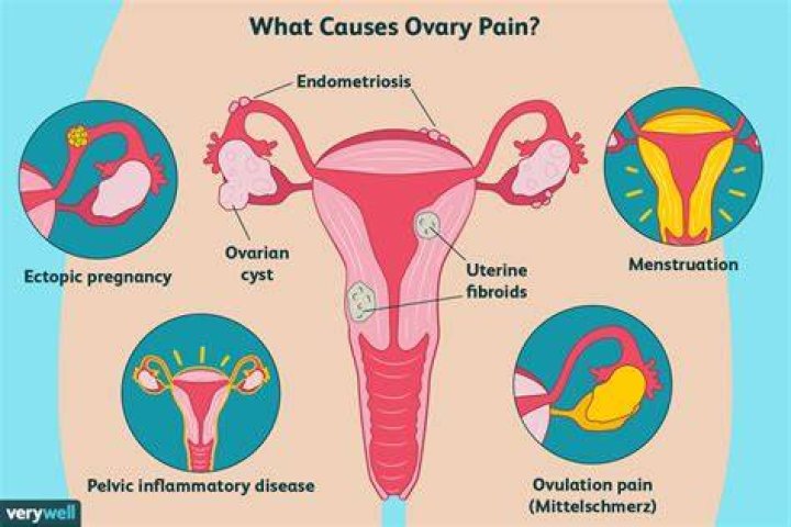 Why do ovaries hurt during period?